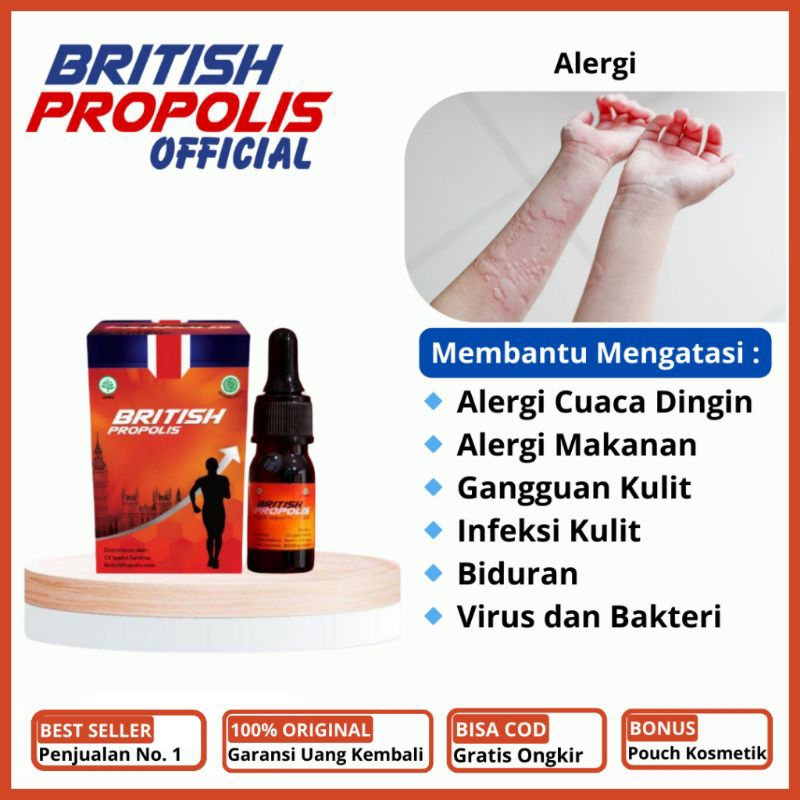 British Propolis - Obat Alergi Gatal Kulit, Alergi Dingin Kulit, Gatal Berair, Gatal Bernanah