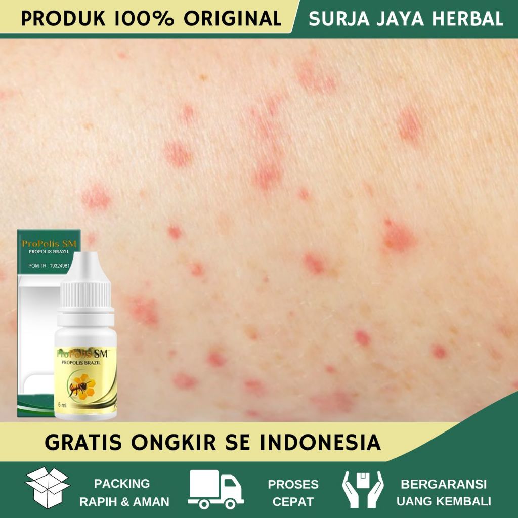 Obat Gatal Selangkangan Eksim Dan Jamur, Obat Gatal Di Selangkangan Masalah Kulit Pria Wanita, Obat 