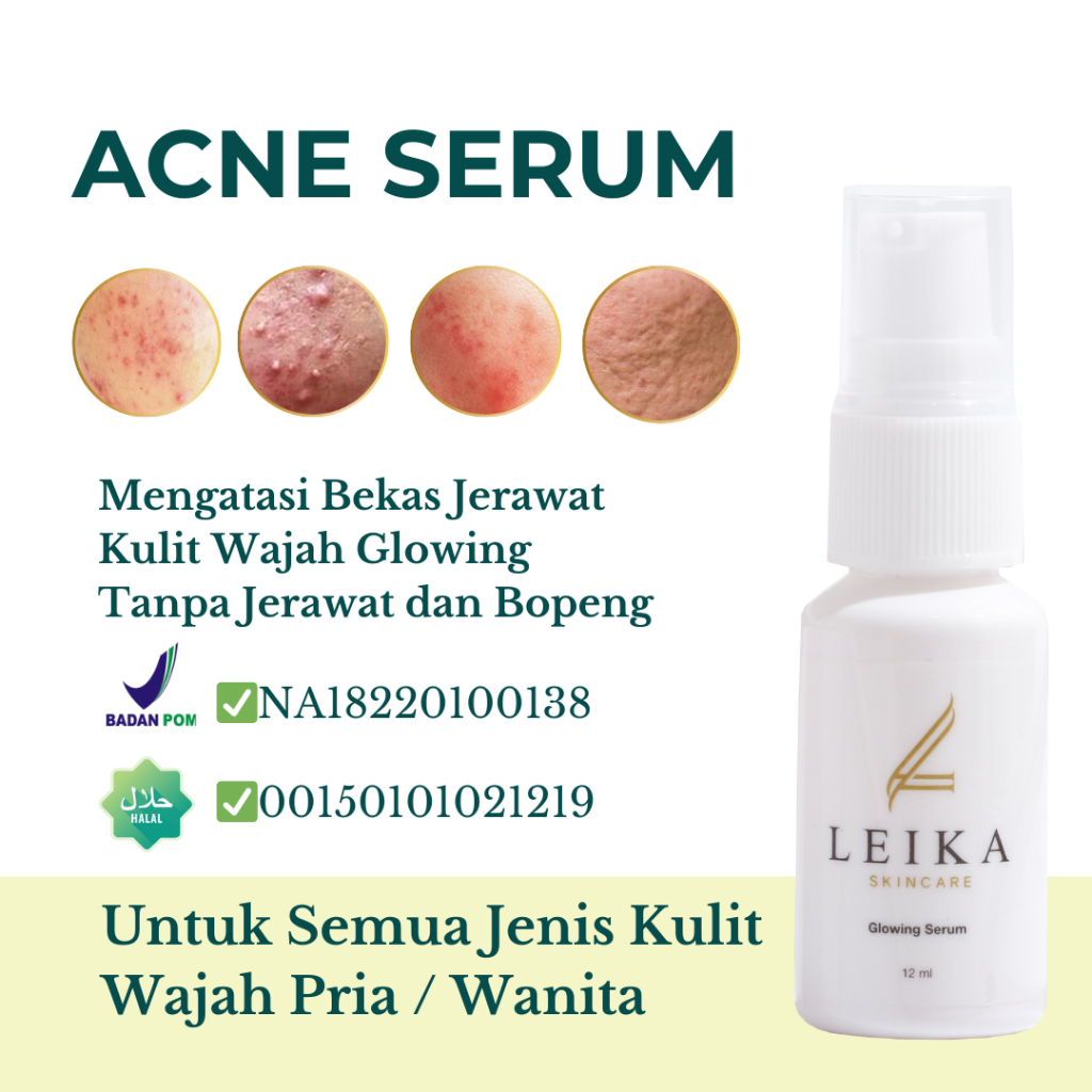 Ampuh Permanen Acne Serum Bopeng dan Pori Pori Besar Bekas Jerawat Penghilang Jerawat obat jerawat b