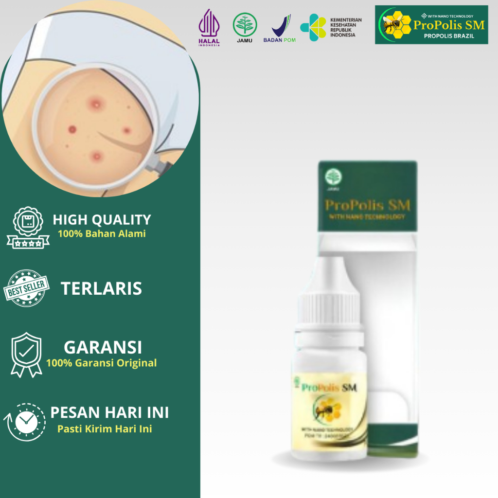 Propolis SM gatal pantat dan selangkangan Bruntusan Koreng Hitam Di Pantat Burik tinea Cruris Pantat