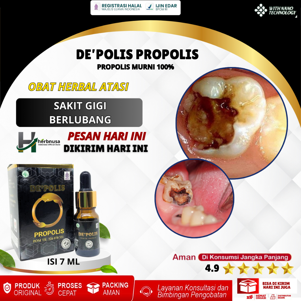 Obat Gigi Berlubang, Obat Herbal Gigi Berlubang, Obat Gigi Berlubang Agar Copot, Gigi Berlubang Biar