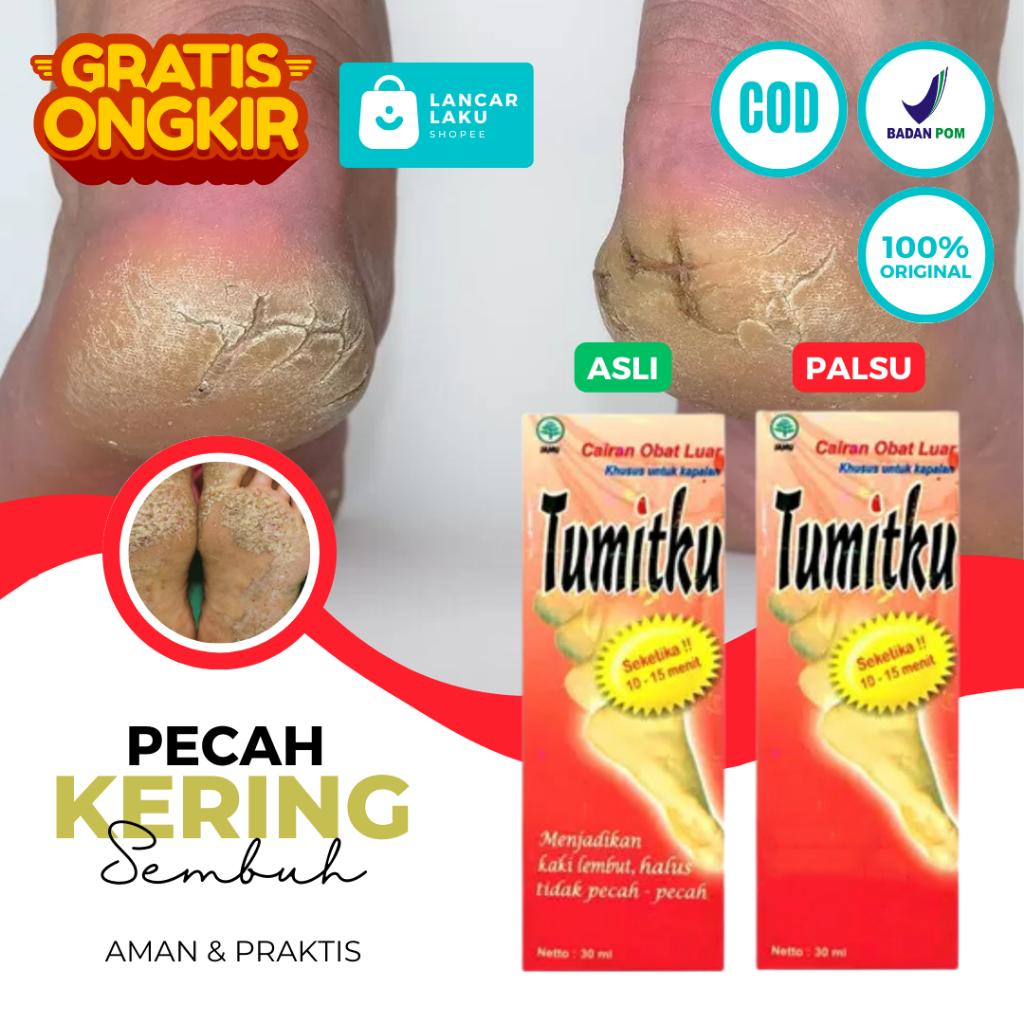 [ORIGINAL] Salep Kaki Pecah Dan Kering Ampuh -  Obat Tumit Pecah Dan Kering Pembersih Kaki Pecah Dan