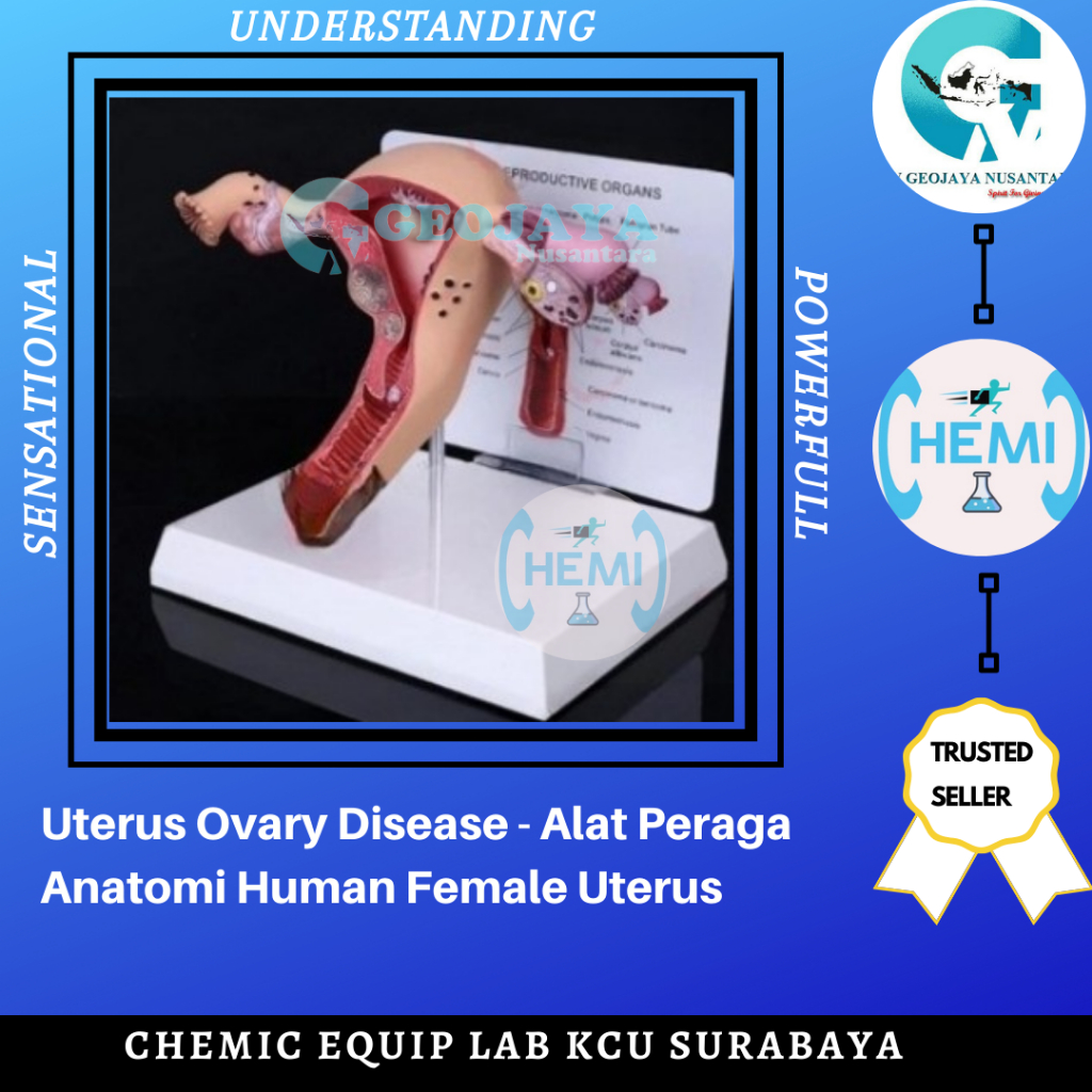 Uterus Ovary Disease - Alat Peraga Anatomi Human Female Uterus