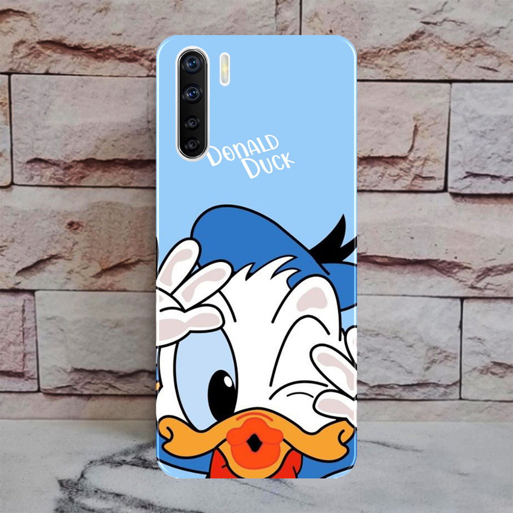 Hardcase OPPO A91/ RENO 3 - Casing Hp - Hardcase Case Hp OPPO A91/ RENO 3- Casing Hp - Hardcase- Cas