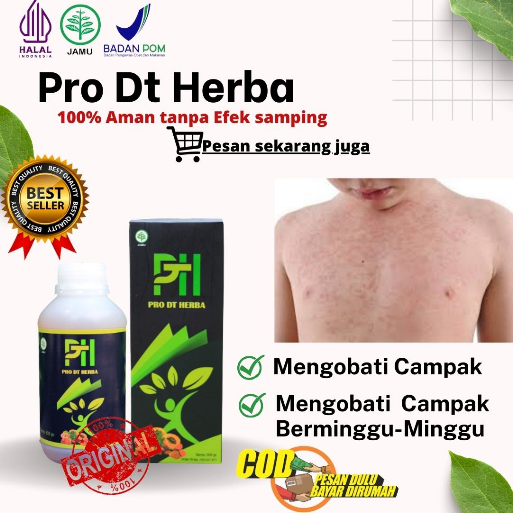 Obat Biduran, Biduran Alergi, Kaligata, Campak, Alergi Dingin Gatal ,Biduran Kronis, Biduran Menahun