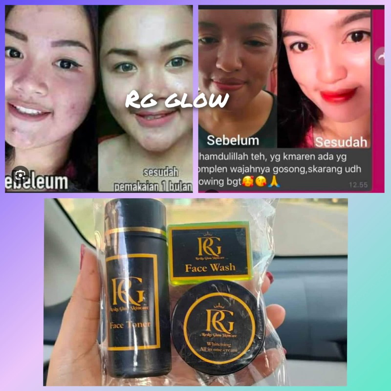 RESKY GLOW SKINCARE ( RG GLOW )
