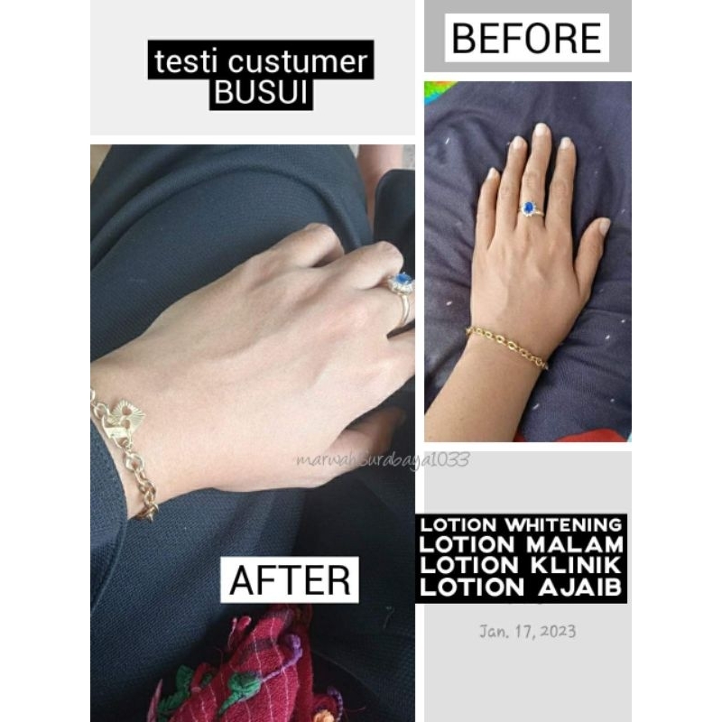 HB KLINIK / LOTION RACIKAN DOKTER / 100% AMAN