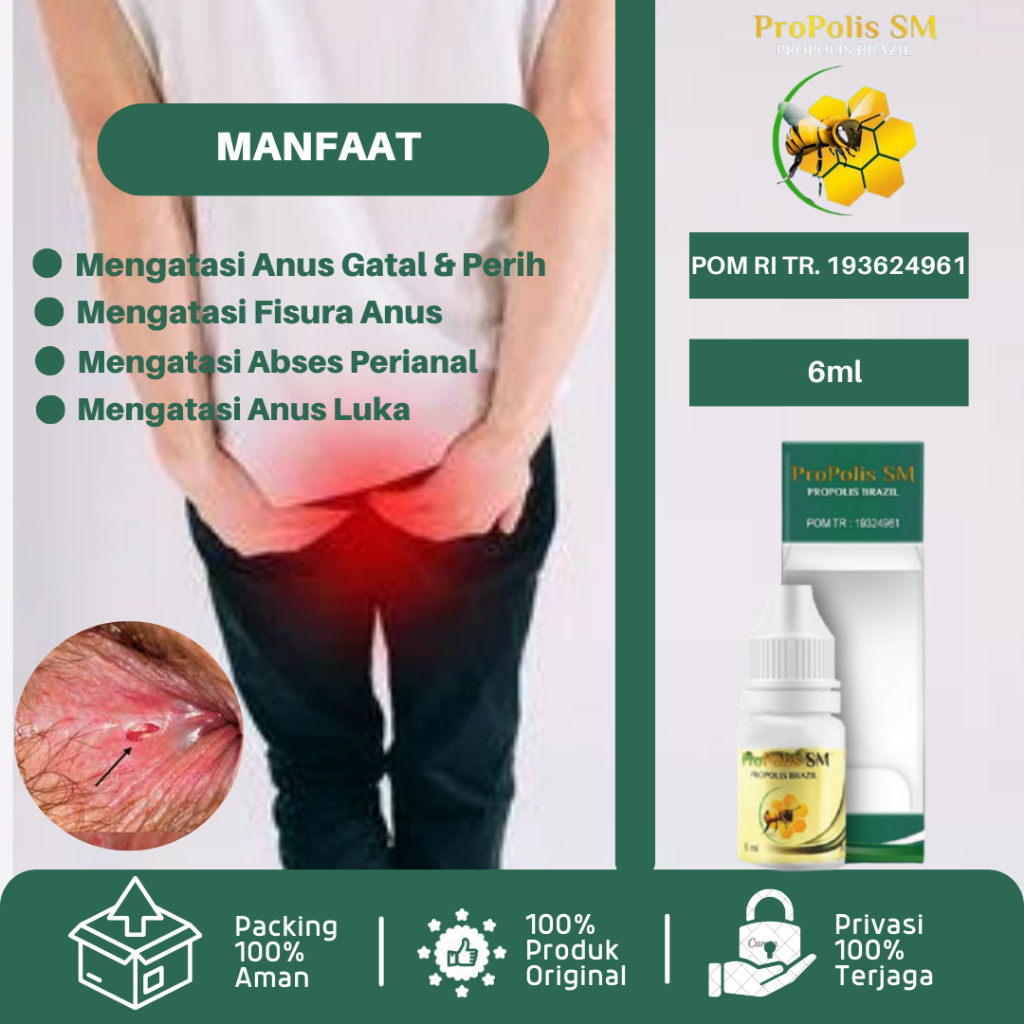 Obat Anus Gatal, Obat Anus Gatal Dan Perih, Obat Anus Luka, Obat Fisura Anus, Obat Lubang Dubur Peri