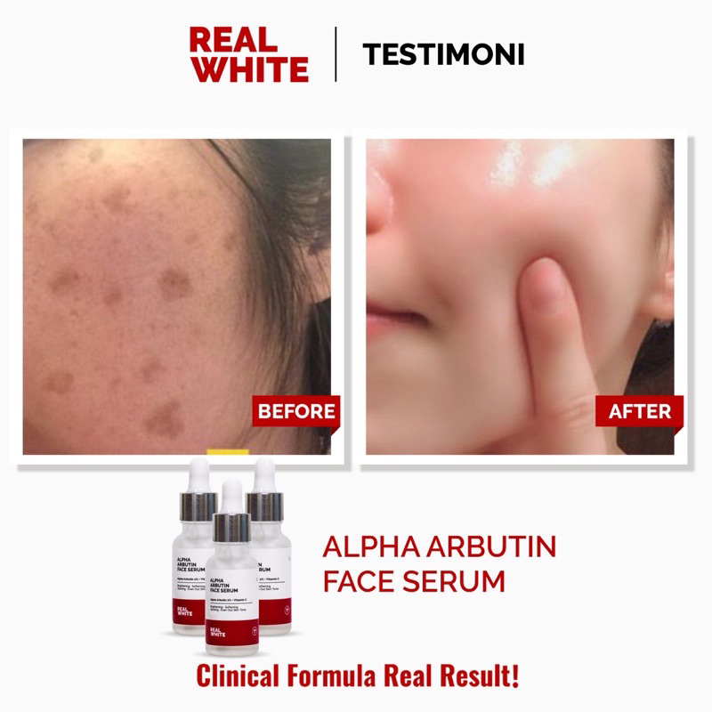 REAL WHITE Alpha Arbutin Serum real white BPOM face serum realwhite alpha arbutin