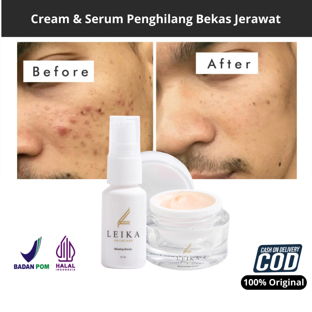 PAKET 2in1 [Night Cream & Serum] Penghilang Jerawat Dan Bekas Jerawat Penghilang Jerawat Ampuh Pengh