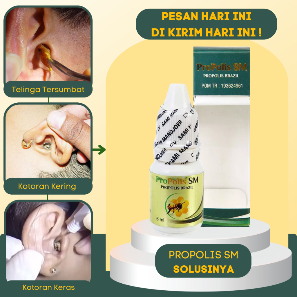 Obat tete.s telinga pelembut pelunak Obat sakit telinga Obat penyumbat telinga tetesan kotoran telin