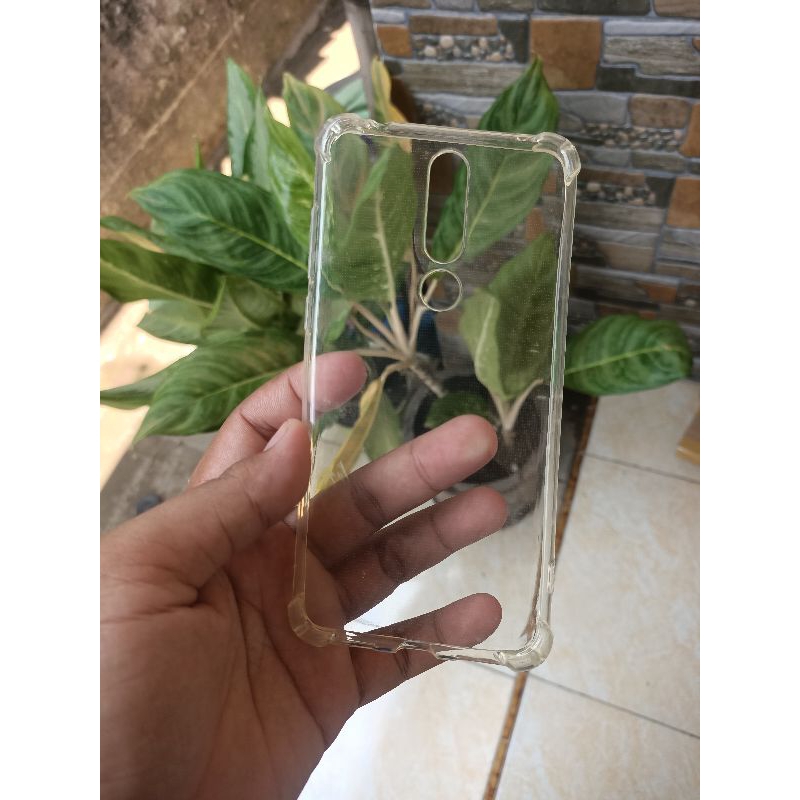 Softcase Nokia 3.1 Plus Case Nokia 3.1 Plus