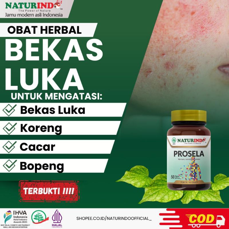 Obat Bekas Luka Koreng Cacar Bopeng Bekas Jerawat Herbal Ampuh