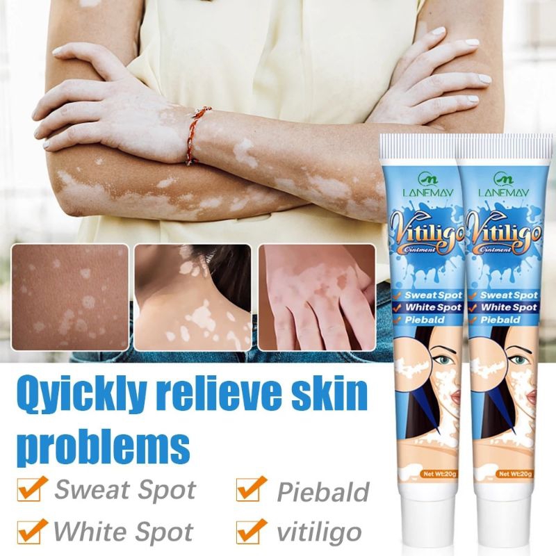 (100%Asli ampuh)Salep Lanemay salep vitiligo ampuh/salep bercak putih kulit