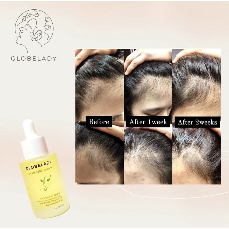 GLOBELADY BPOM Hair Care Serum 100% Natural Oil (Serum Rambut / Hair Oil)