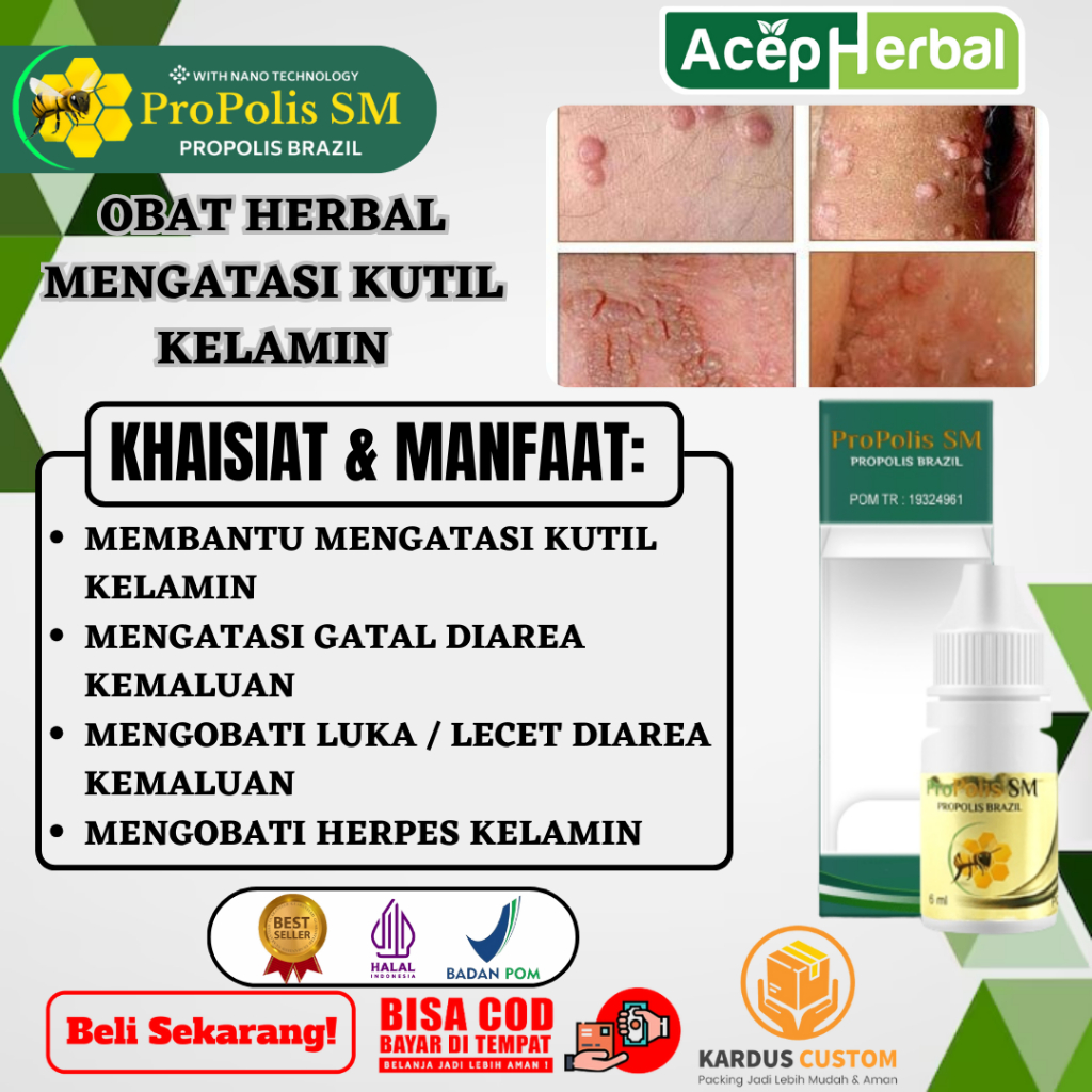 Obat Kutil Kelamin Gatal Diarea Kemaluan Luka Atau Lecet Diarea Kemaluan Mengobati Herpes Kelamin De