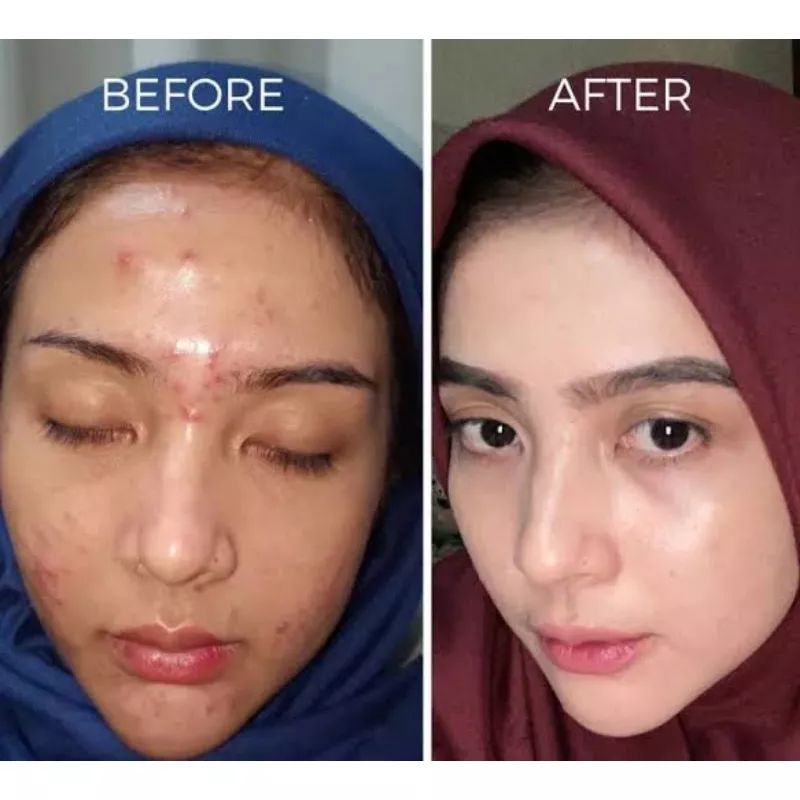 COLLAGEN SOFTGEL BOOSTER COD