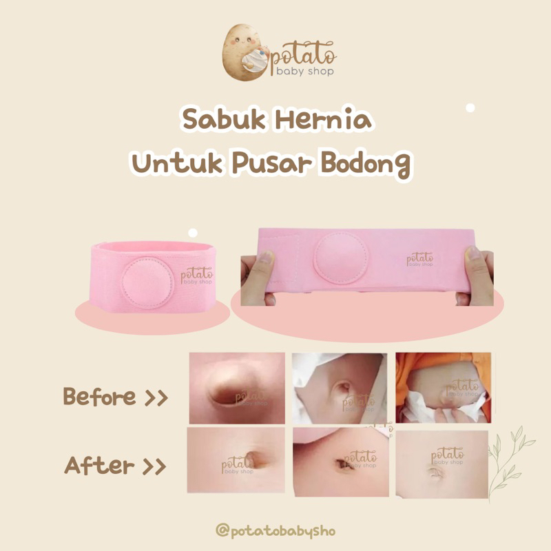 Infantible Umbilical Hernia Belt - Sabuk pusar bodong Bayi