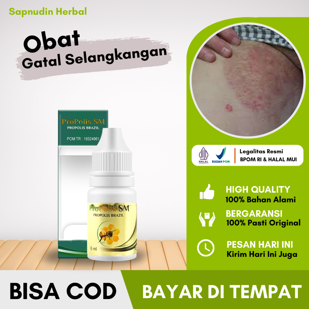 Obat Gatal Selangkangan Pria Dan Wanita, Obat Jamur Selangkangan, Obat Eksim Kering, Obat Eksim Basa