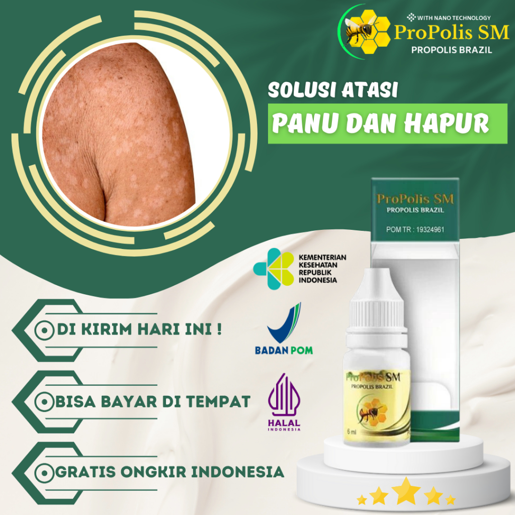 Obat Penghilang Panu, Obat Hapuran Kulit, Obat Penghilang Panu, Obat Hapur Di Punggung, Obat Panu Se
