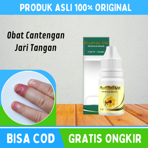 Obat Cantengan Jari Tangan, Obat Cantengan Jari Kaki, Obat Cantengan Parah, Obat Cantengan, Obat Can