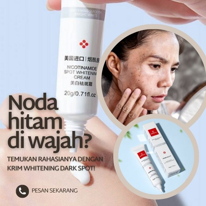 YOUBUY WHITENING FRECKLE CREAM REMOVE DARK SPOTS ANTI FRECKLE CREAM | CREAM PENGHILANG FLEK HITAM OR