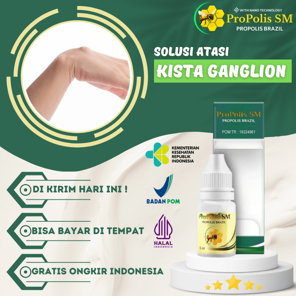 Obat Kista Ganglion,Obat Benjolan di Tangan, Obat Benjolan Lipoma, Obat Benjolan Di Tangan, Obat Ben