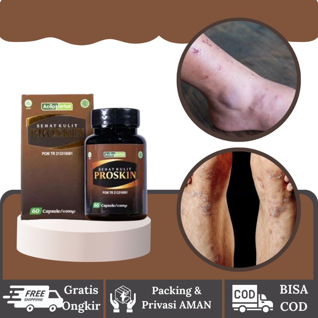 Herbalthy - Obat Korengan - Obat Koreng di Kaki - Proskin 60 Kapsul