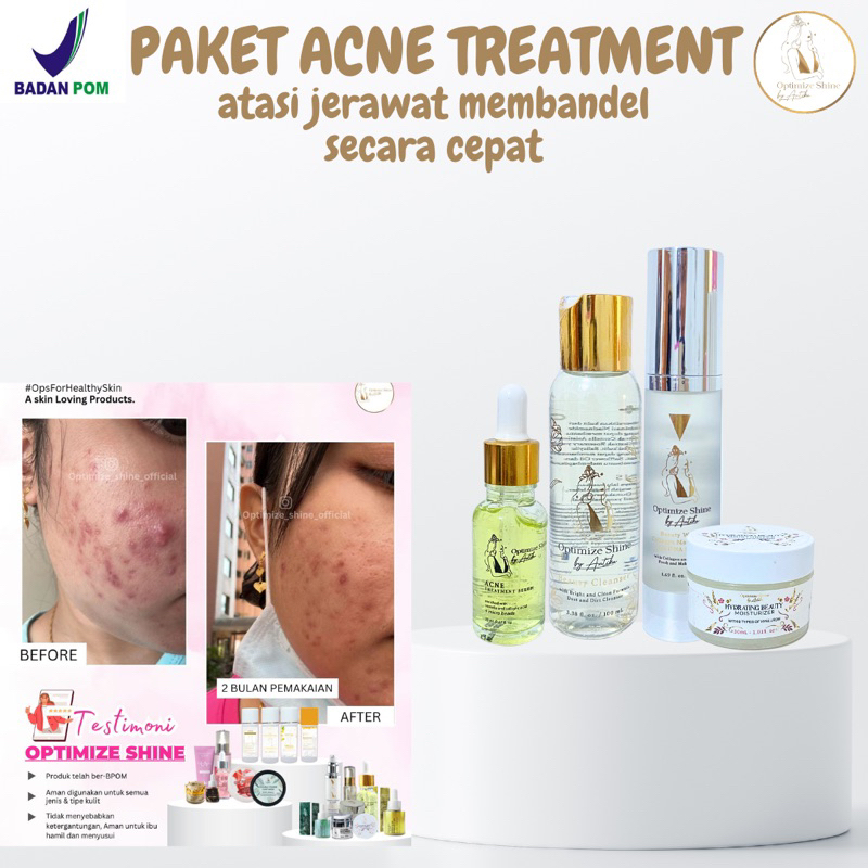 [OPTIMIZE SHINE] PAKET ACNE THREATMENT Penghilang Jerawat Dan Beruntusan