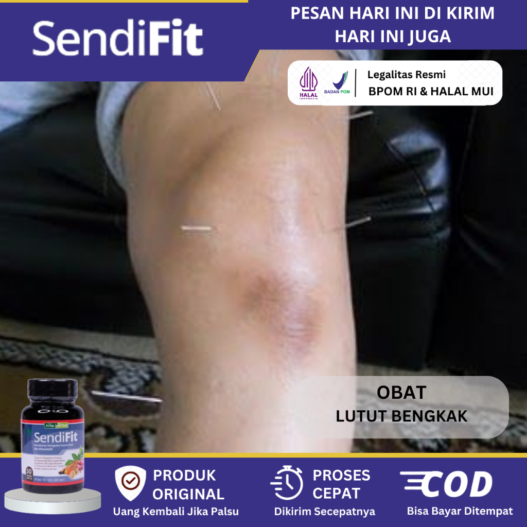 Obat Sakit Lutut Bengkak Secara Alami, Obat Lutut Bengkak, Asam Urat, Rematik, Radang Sendi, Nyeri S