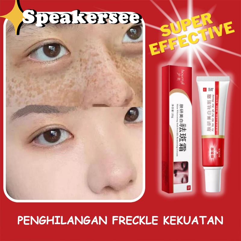 [Ready stock]Houmal Whitening Freckle Cream/ Krim Pemutih Penghilang Bintik Wajah Krim Asli Efektif 