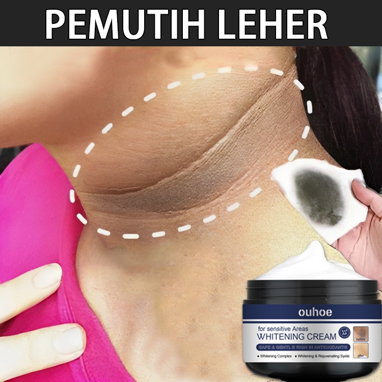 Pemutih selangkangan pencerah ketiak dan selangkangan memutihkan selangkangan hitam Krim pemutih 30m