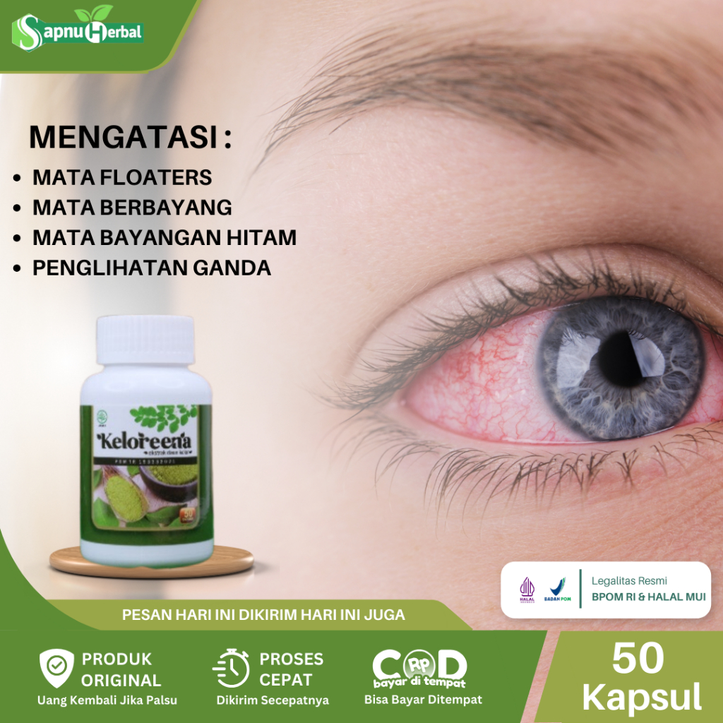 Obat Mata Floaters, Pengobatan Mata Floaters, Mata Berbayang, Mata Merah, Katarak, Mata Bayangan Hit