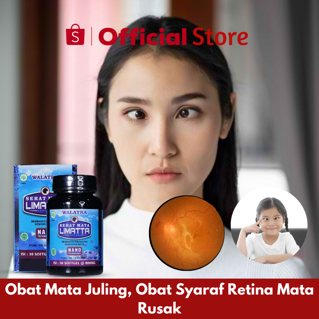 Obat Mata Juling, Obat Syaraf Retina Mata Rusak, Obat Mata Juling Sebelah, Obat Mata Jereng, Obat St