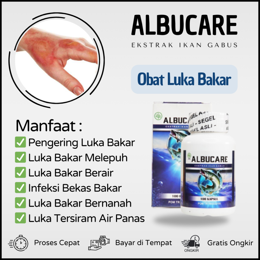 Obat Luka Bakar, Obat Luka Bakar Melepuh, Obat Luka Bakar Bengkak, Obat Luka Bakar Merah, Obat Luka 