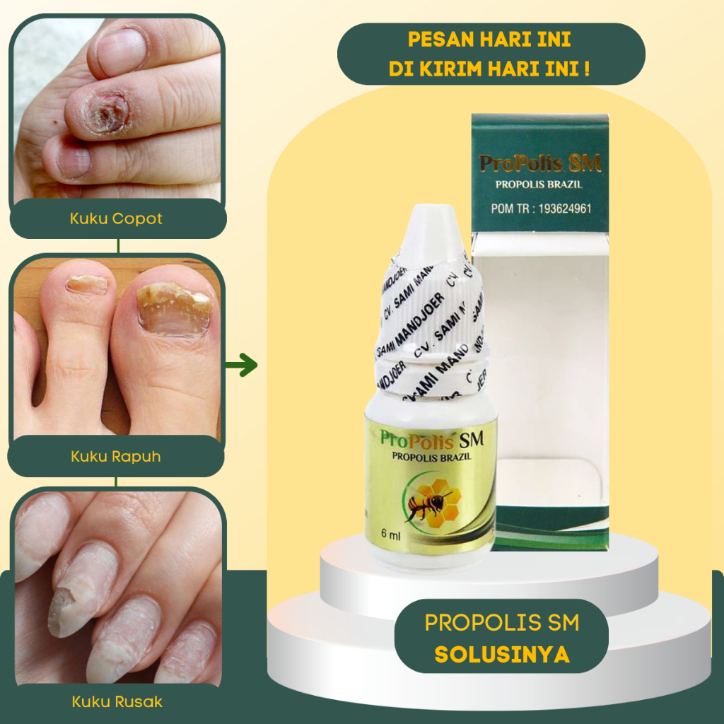 Obat Vitamin Kuku - Obat Jamur Kuku - Obat Perawatan Kuku Rusak - Obat Infeksi Jamur Kuku - Obat Kuk