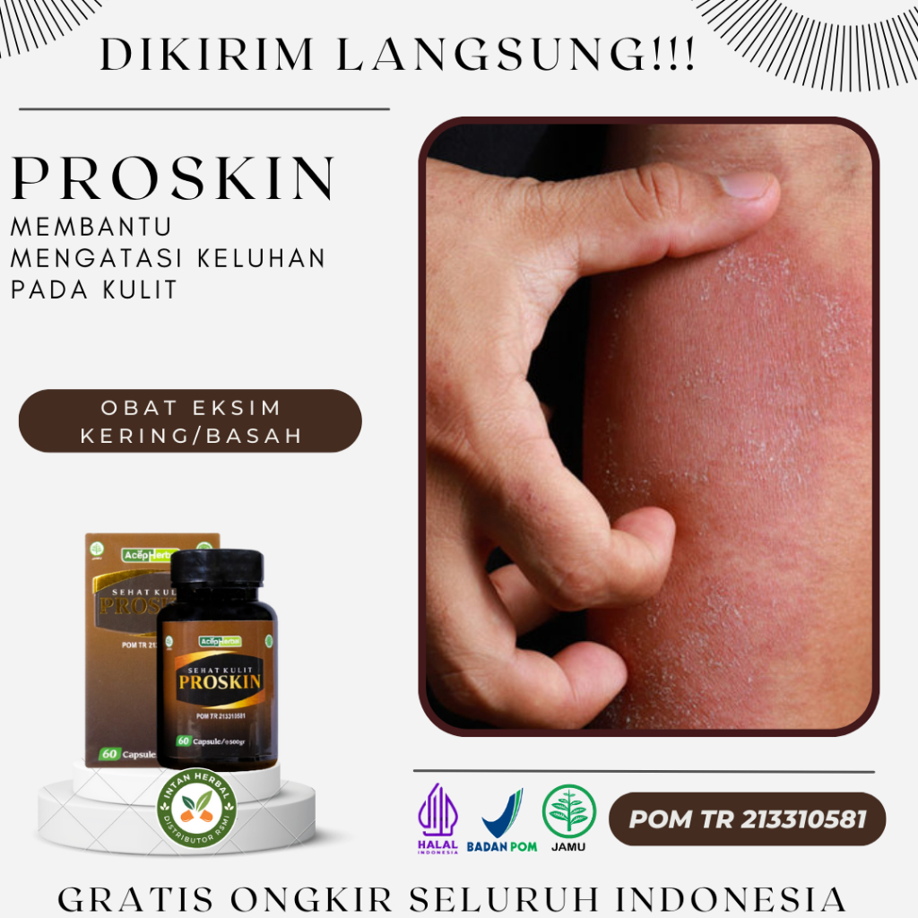 Proskin 100% Original - Obat Eksim Kering/Basah, Gatal Eksim Menahun, Kulit Kering, Dermatitis Stati