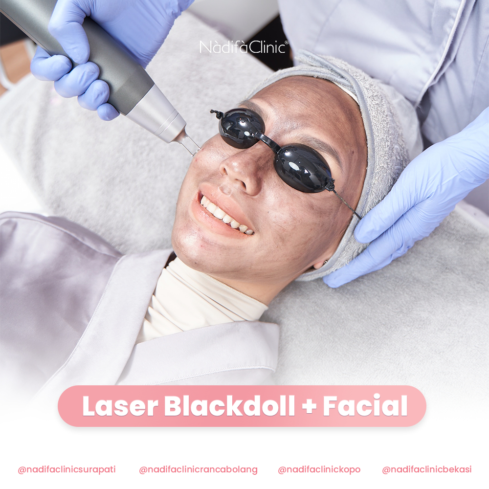 Laser Blackdoll + facial