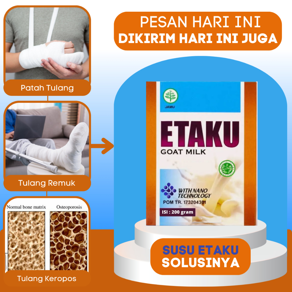 Obat Patah Tulang Retak Remuk Tulang Bergeser - Susu Kalsium Pengapuran Tulang Sendi Keropos Osteopo