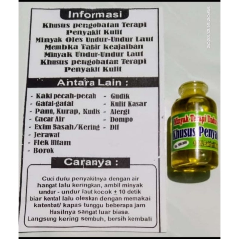 Minyak Undur Undur Laut Mengobati Gatal Kulit Paling Ampuh 30 ml