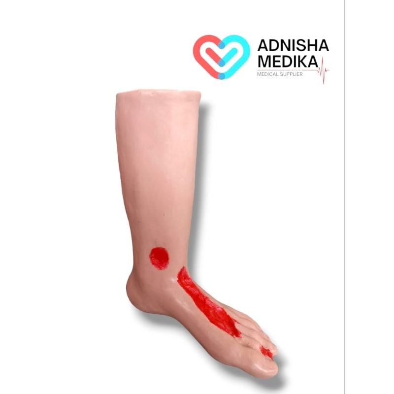 PHANTOM MANIKIN MODEL KAKI LUKA / MANEKIN MODEL KAKI LUKA