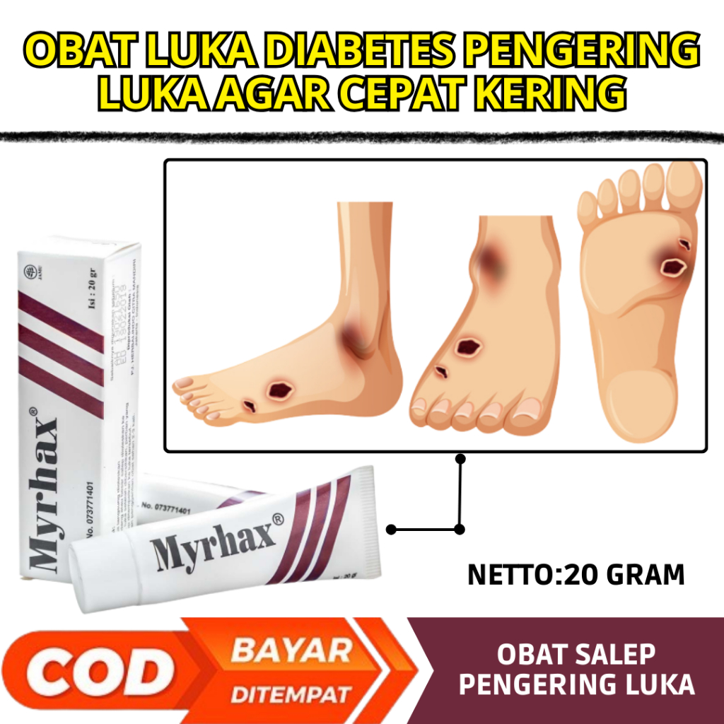 Obat Luka Diabetes Obat Pengering Luka Diabetes Obat Luka Diabetes Kering Obat Luka Diabetes Basah O