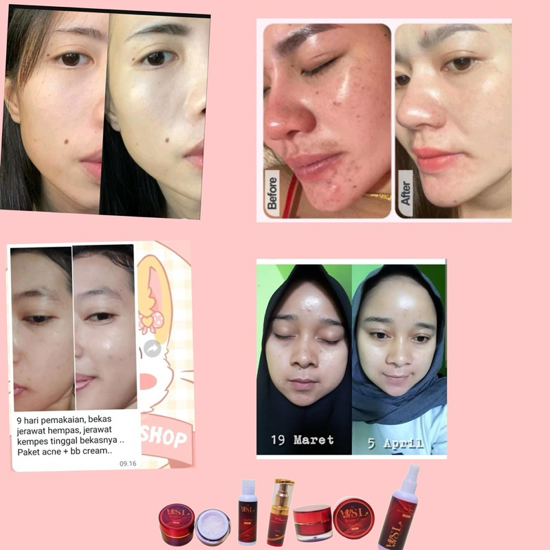 Wajah Glowing Putih Bersih Bebas Jerawat Dengan Skincare Bpom Dari WSL
