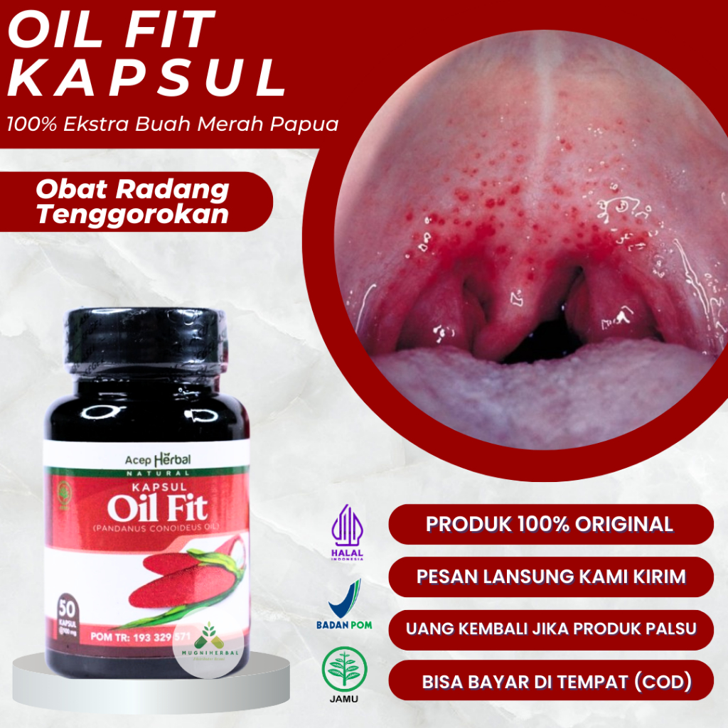 Oil Fit Kapsul - Obat Radang Tenggorokan, Tenggorokan Kering, Batuk Berdahak, Radang Tenggorokan Kro