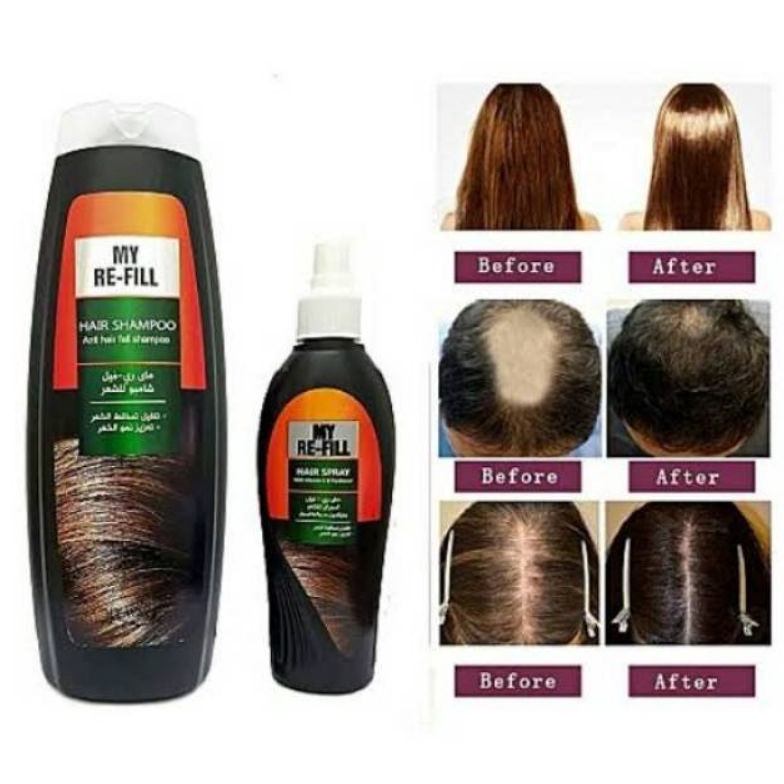 Best Pruk MY WAY shamp My Refill shamp Nature anti rntk 95