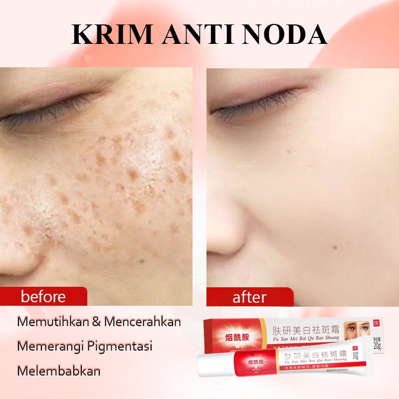 Cream Pemutih Wajah Bintik Efektif 7X Niacinamide Melasm Cream 100% Original Cream Penghilang Flek H