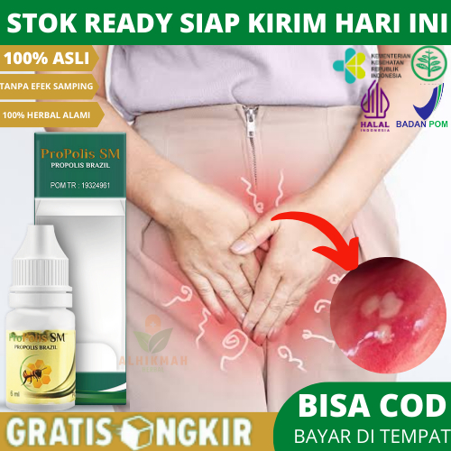 Obat Luka Lecet Di Bibir Miss V, Obat Miss V Sariawan, Obat Miss V Gatal Dan Perih, Obat Miss V Saki