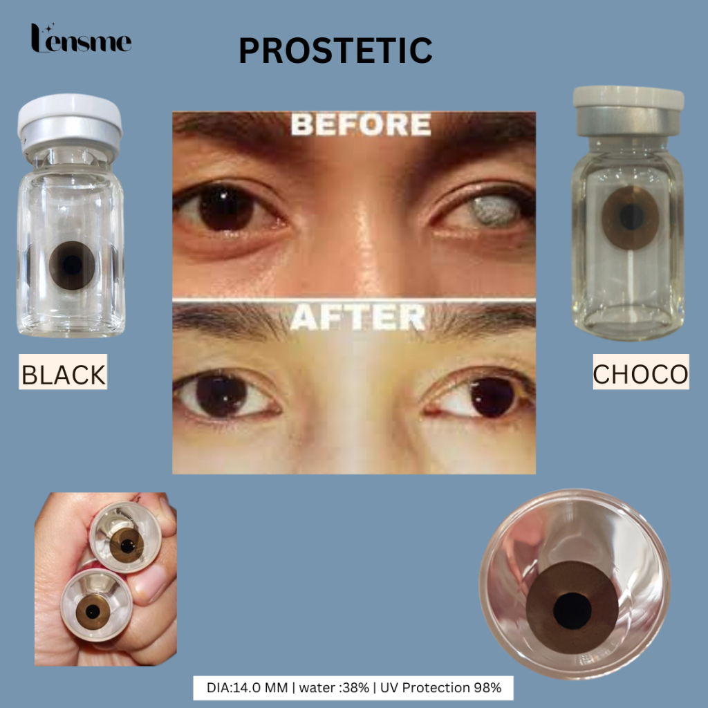 Lensme Softlens Prosthetic Iris Mata Cacat