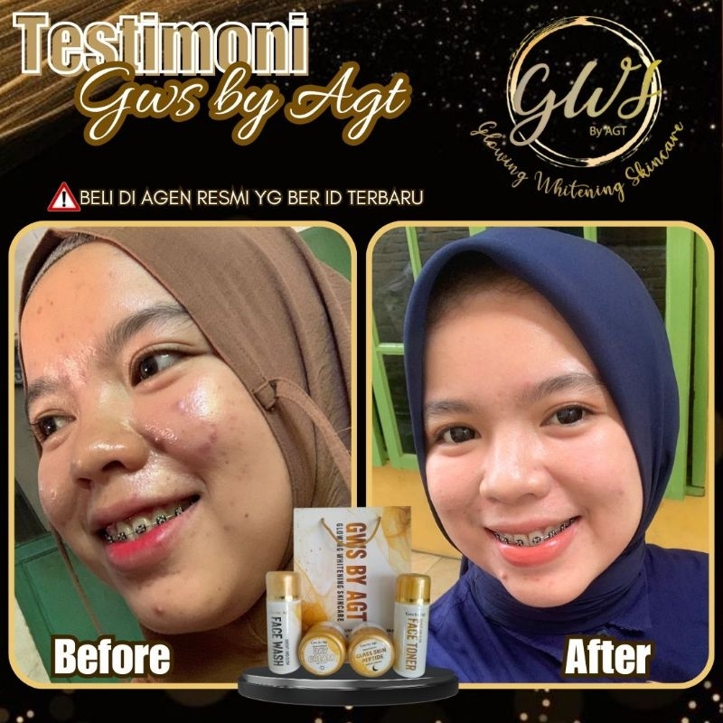 GWS SKINCARE BY AGT
