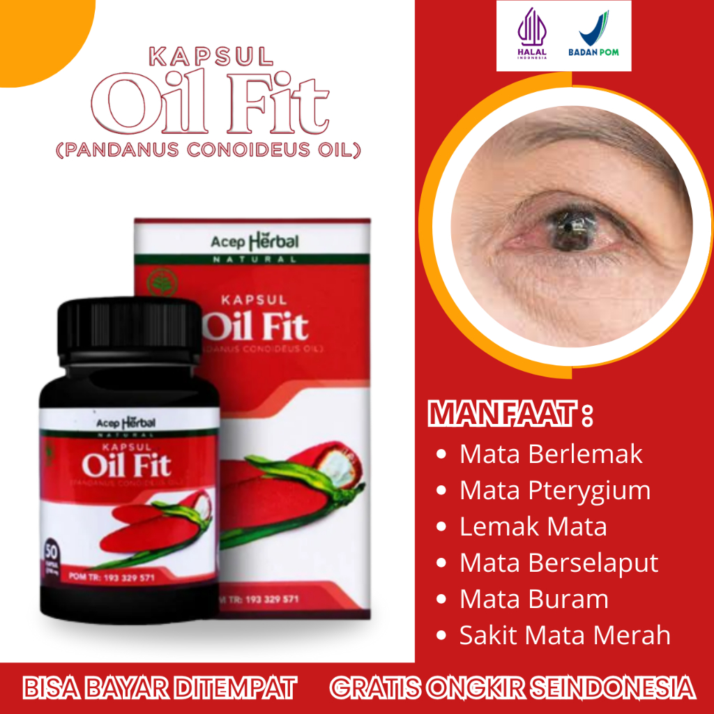 Obat Mata Berlemak, Obat Untuk Mata Berlemak, Obat Mata Merah Berlemak, Obat Pterygium, Obat Pterigi